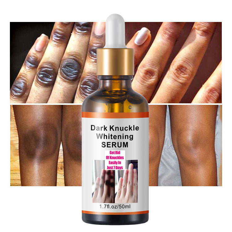 MOOYAM Dark Knuckle Whitening Serum