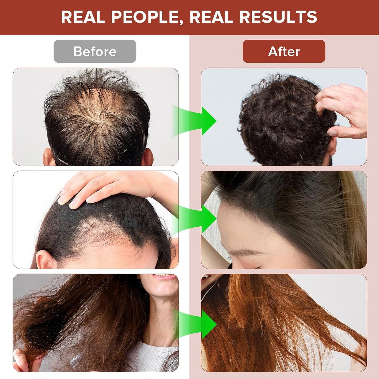 100% Raw Batana Oil, For All Hair Types, Grow Thicker-Stronger Hair, Repair Damaged Hair