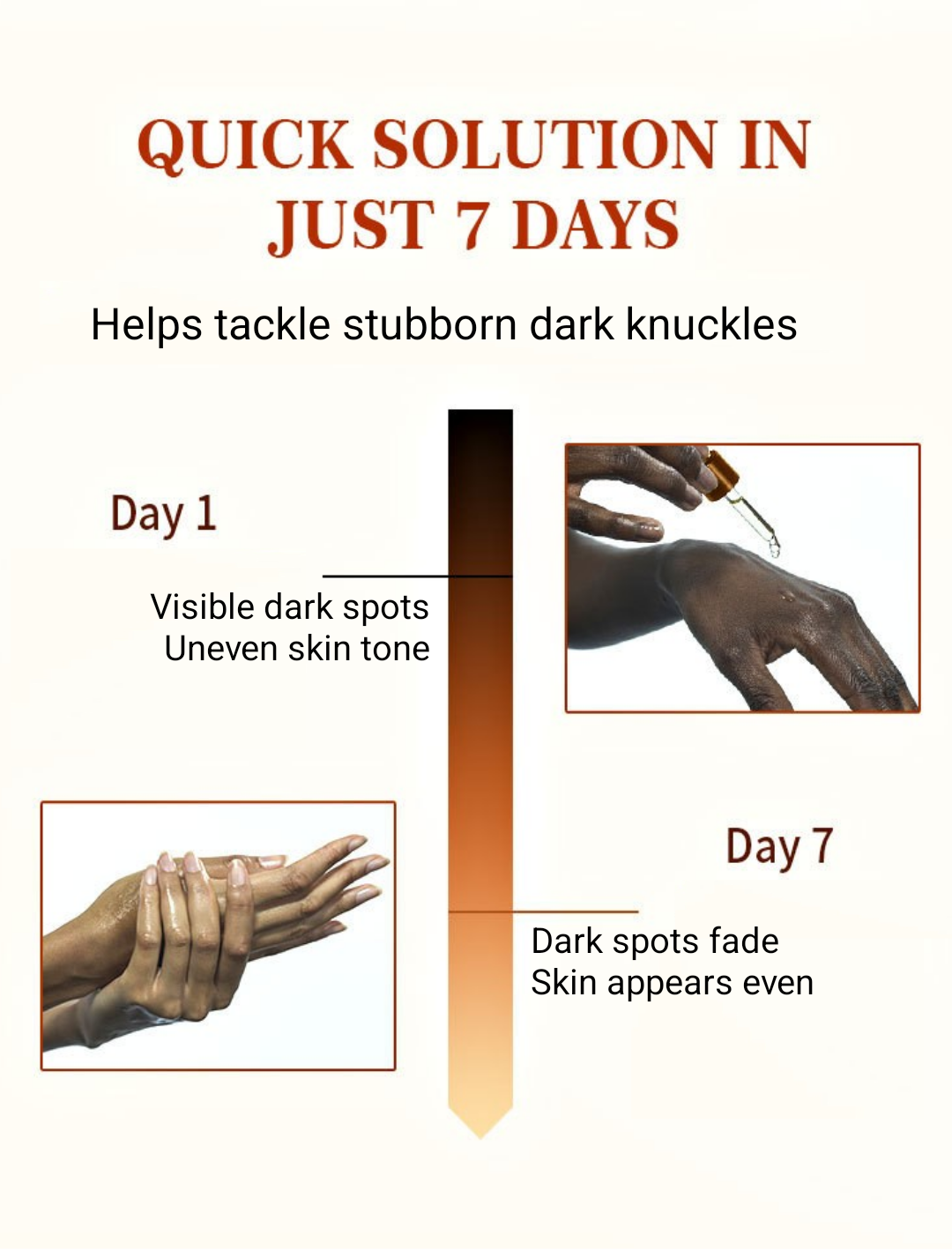 MOOYAM Dark Knuckle Whitening Serum –  50 ml